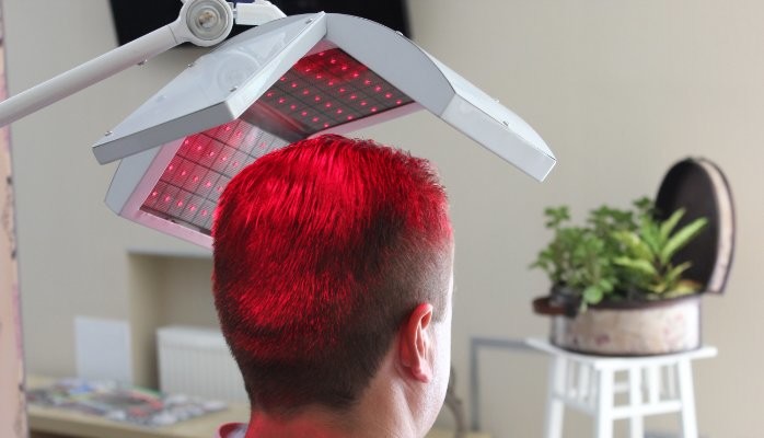 Best Alopecia Areata Treatments for Hair loss | Laser and Light therapy